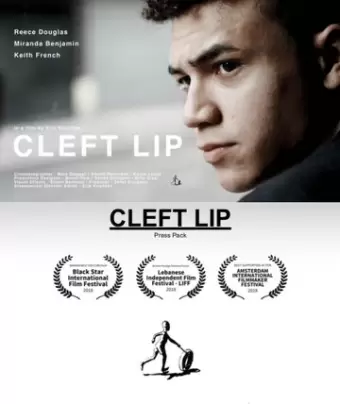 Заячья губа / Cleft Lip